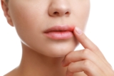 How Laser Therapy Can Help Treat Cold Sores – Summit Dental Health