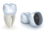 Restore Smile With Dental Crowns for Teeth West Chester